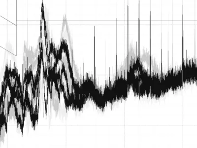 Mitigación del efecto EMI en señales audiovisuales